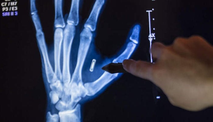 —تصویر بشکریہ غیر ملکی میڈیا