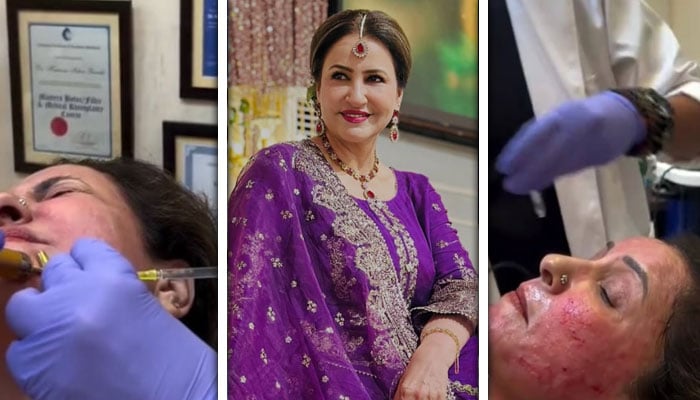 تصاویر: سوشل میڈیا