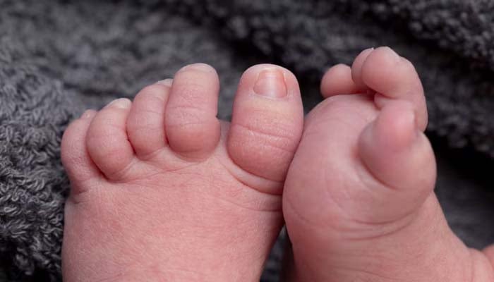 US stillbirths decline slightly, yet 20,000 pregnancies still end in loss