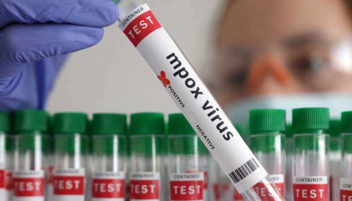 New mpox variant detected in UK after traveler returns from Asia