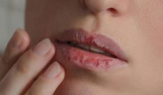 سردیوں میں ہونٹ کیوں خشک ہوتے ہیں؟