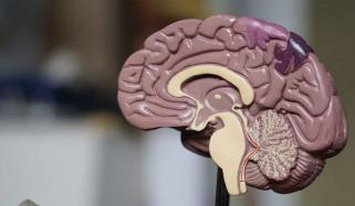 میگنیشیم کی کمی کس دماغی بیماری کا خطرہ بڑھا دیتی ہے؟