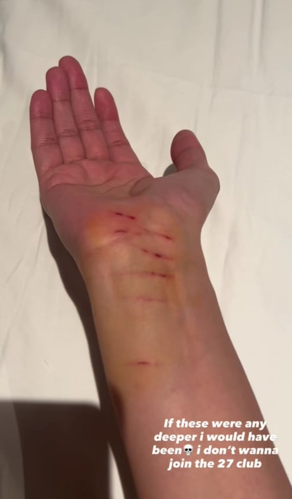 Picture Credit: Shae Gill/ Instagram