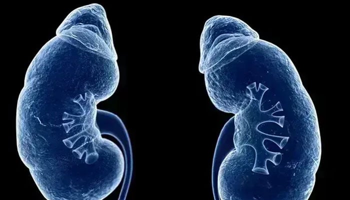 Severe CKD patients at significantly higher risk of Gastroparesis, study