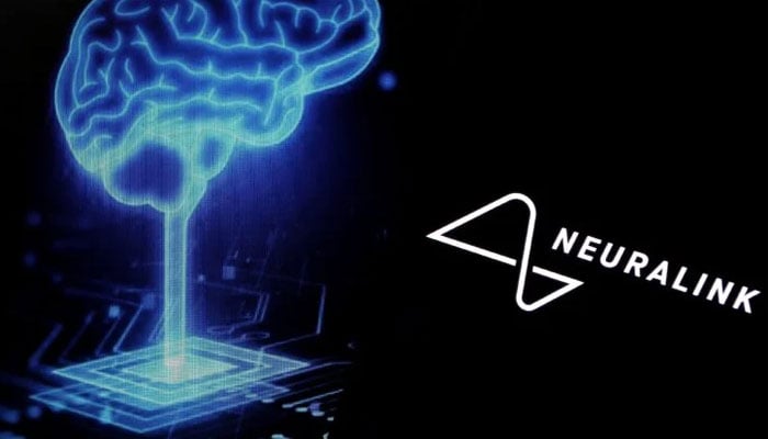 Neuralink prepares for bulk production of brain implants by 2026