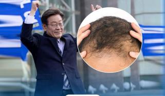 جنوبی کوریا کے صدر نے گنج پن کو سنگین مسئلہ قرار دے دیا