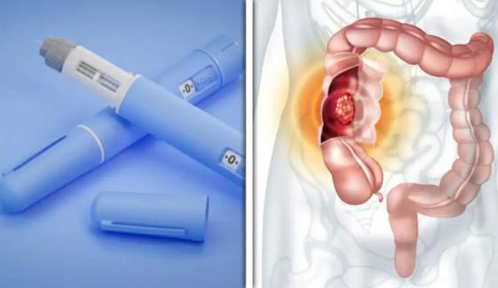 اوزیمپک اور ویگووی آنتوں کے کینسر کے خطرے میں کمی کیلئے مددگار، تحقیق