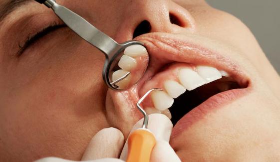 طویل عمری دانتوں کی صحت پر منحصر ہے: تحقیق 