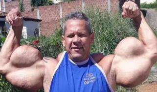 ’ریئل پوپائے‘ کے نام سے وائرل باڈی بلڈر آریلینڈو ڈی سوزا انتقال کرگئے