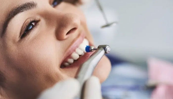 دانتوں اور شریانوں کے پلاک کا نام یکساں، چیزیں مختلف