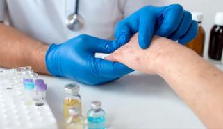 خسرہ عالمی خطرہ بن گیا، دنیا بھر میں ایک بار پھر وبا کیوں پھیل رہی ہے؟