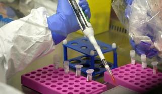 پاکستان میں نپاہ وائرس کا کوئی کیس رپورٹ نہیں ہوا: ایڈوائزری