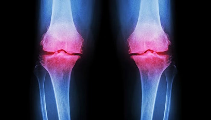 ورزش کے بعد دودھ پینے سے بڑھاپے میں ہڈیاں مضبوط ہوسکتی ہیں، تحقیق