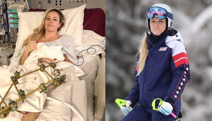Lindsey Vonn shares health update after nearly losing leg in Olympic crash