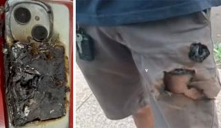 جیب میں پڑے موبائل نے دھماکے سے پھٹ کر برازیلین شہری کی جان بچالی 