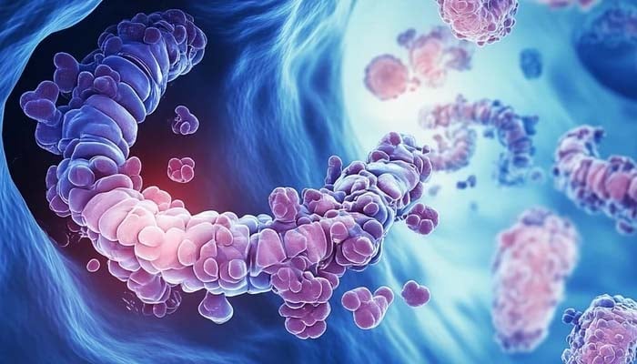 Colorectal cancer increasing sharply among youngster, study