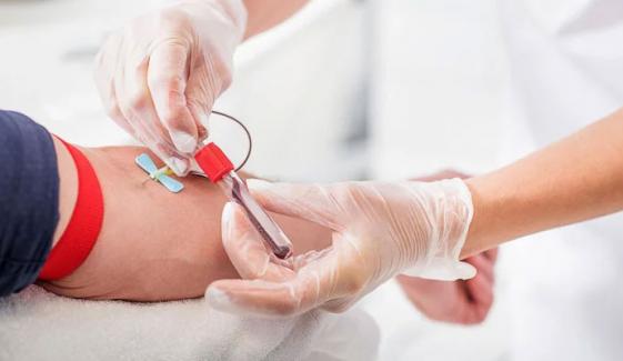 کیا خون ٹیسٹ یا عطیہ کرنے سے روزہ ٹوٹ جاتا ہے؟
