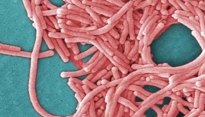 Legionnaires disease outbreak: Deadly bacteria sparks health alert