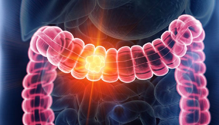 علامتی فوٹو