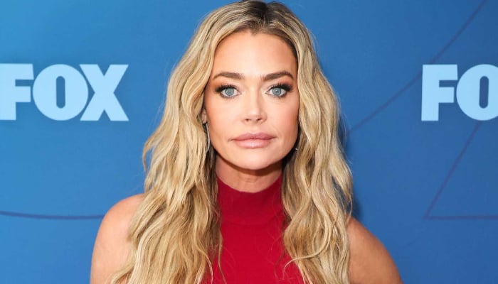 Denise Richards stuns with unbelievable facelift transformation: See