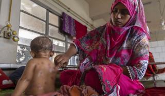 بنگلا دیش: خسرہ کے مشتبہ پھیلاؤ سے 98 بچے ہلاک، ویکسینیشن مہم تیز