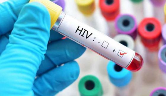 اسلام آباد میں HIV کے کیسز میں خطرناک اضافہ