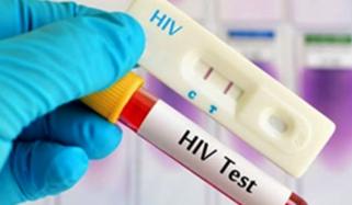 اسلام آباد میں ایچ آئی وی پھیلاؤ کا تاثر غلط، صورتحال کنٹرول میں ہے: وزارتِ صحت