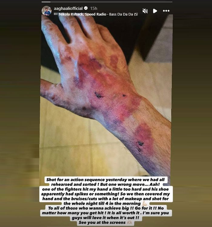 اداکار آغا علی شوٹنگ کے دوران زخمی ہو گئے