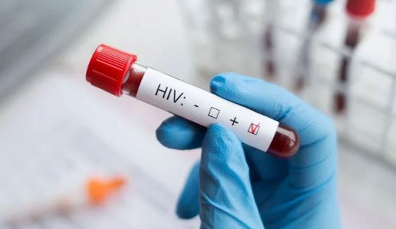 2025ء: پاکستان میں HIV کے کتنے کیسز رپورٹ ہوئے؟