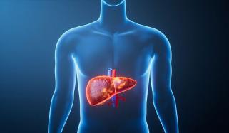 طرز زندگی میں تبدیلی سے جگر کی بیماریوں سے بچاؤ ممکن ہے، تحقیق