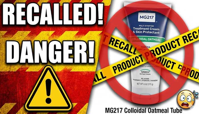 FDA recalls MG217 Eczema cream over Potential Staph contamination