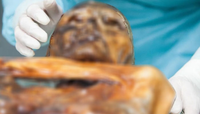 Ancient bacteria still active in 5,300-year-old mummy revealed