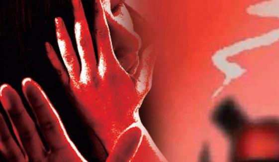 تیزاب گردی کا شکار کوئٹہ کی خاتون ڈاکٹر کراچی میں زیرِ علاج