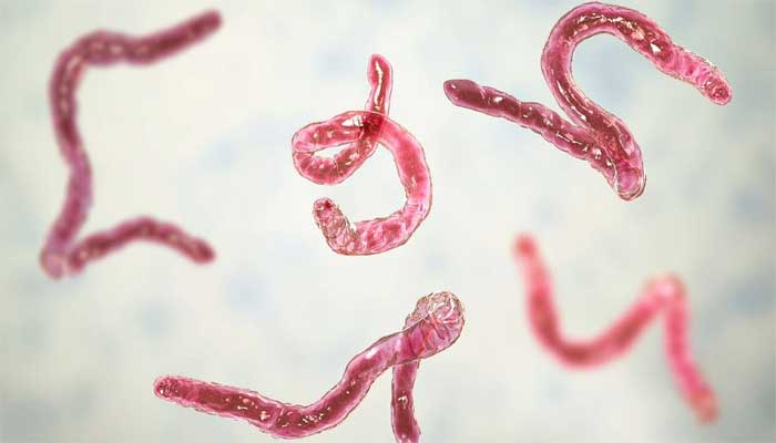 Michigan parasite outbreak infects over 150 people, investigation underway