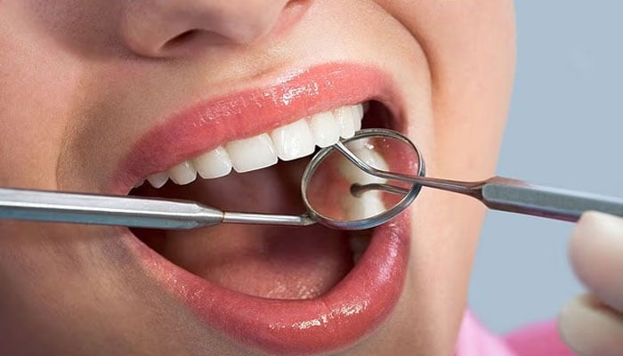 مسوڑھوں سے خون آنا گردوں کی جان لیوا بیماری کی علامت ہو سکتی ہے، تحقیق