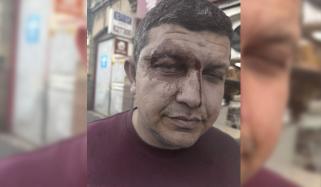 فالکرک میں پاکستانی نژاد ڈاکٹر پر حملے کے بعد کمیونٹی میں تشویش، شہریوں کو احتیاط کی تلقین