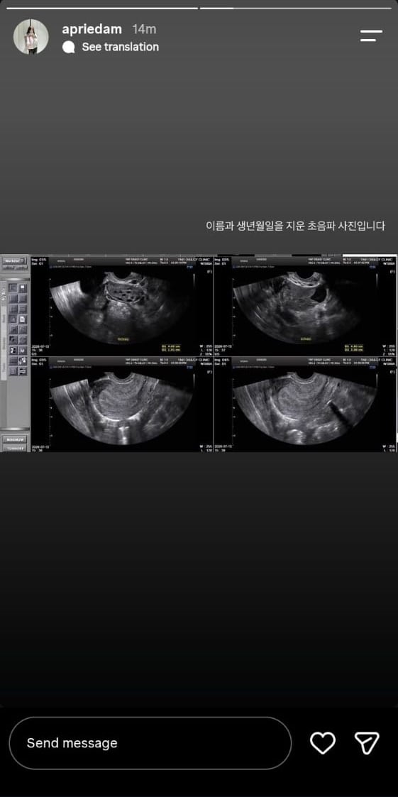 Hong Mingis ex-girlfriend shares disturbing video after actor denies abortion claims