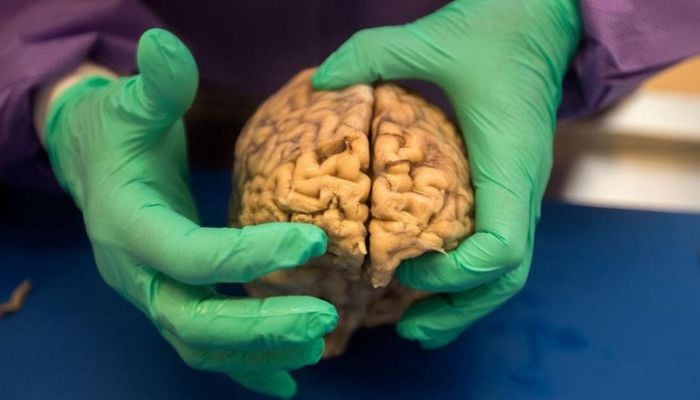 New BMJ study links NFL head injuries to CTE