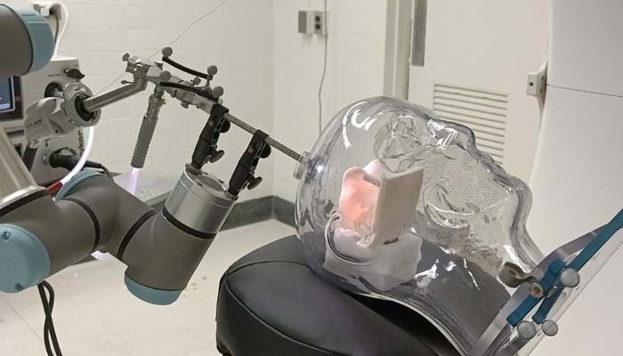 Worlds first AI-assisted brain surgery performed on UK patient