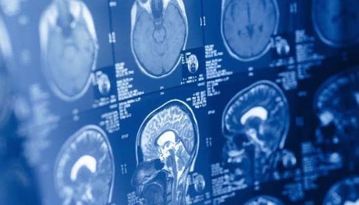 Human brain may be two separate organs, Stanford study finds