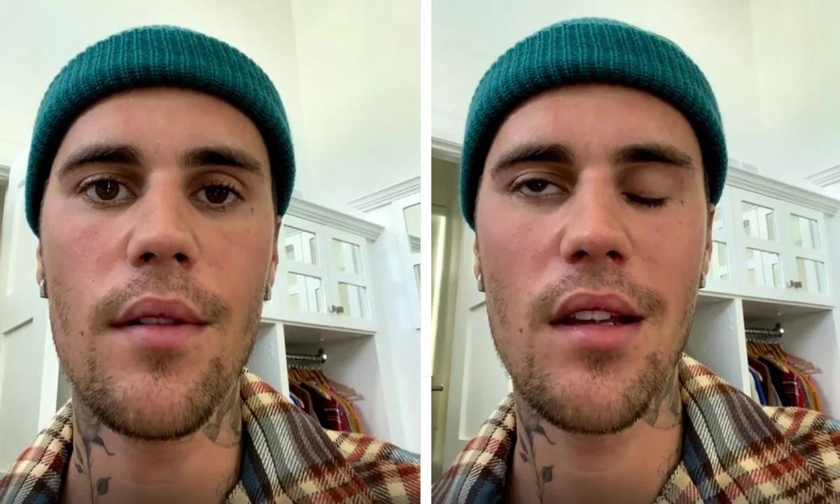 Justin Bieber’s Ramsay Hunt Syndrome diagnosis: His journey through recovery