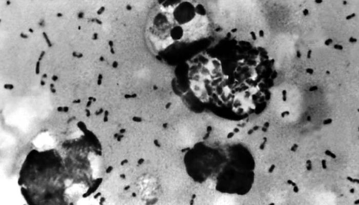 What is pneumonic plague? How dangerous is it and how does it spread?