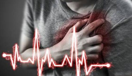 کارڈیک اریسٹ اور ہارٹ اٹیک میں کیا فرق ہے؟