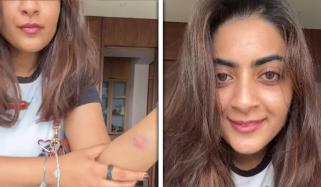 اداکار عامر خان کی بھانجی زین میری نے گرفتاری کے بعد جسم پر چوٹوں کے نشانات دکھا دیے