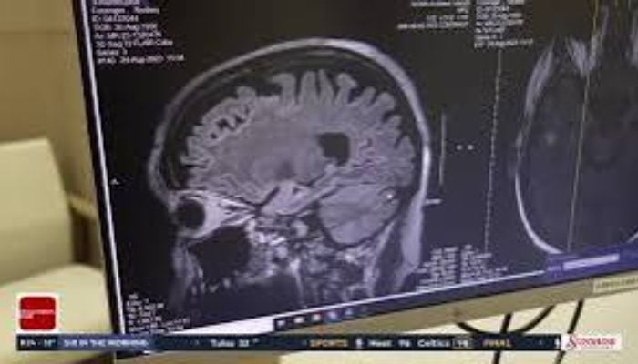 Teen’s dinosaur visions revealed rare autoimmune brain attack