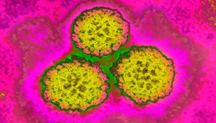 12% of new cancer cases linked to infections, WHO cancer agency reports