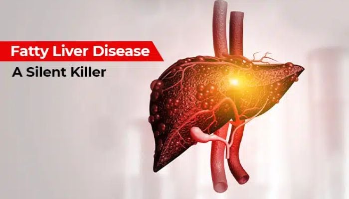 Silent liver disease surges among people who never drink